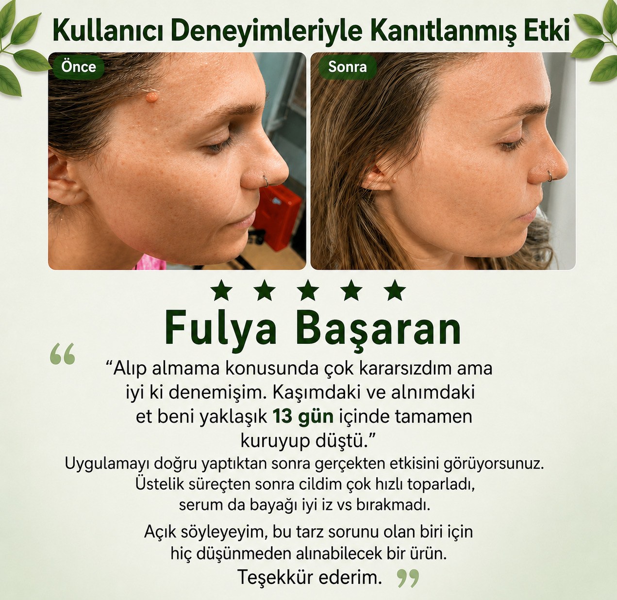 Skinvibe® | Siğil • Nasır • Et Beni Solüsyonu