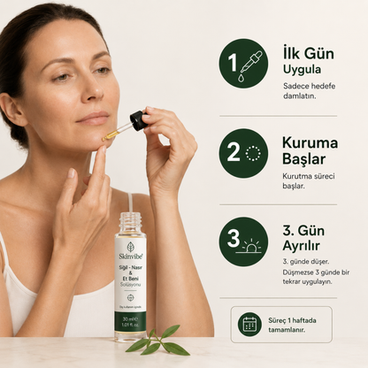 Skinvibe® | Siğil • Nasır • Et Beni Solüsyonu