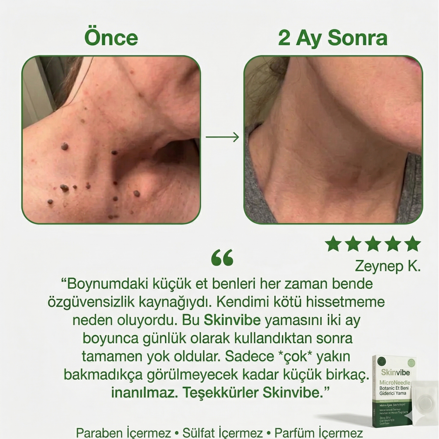 Skinvibe® - Vegan Siğil & Et Beni Bandı