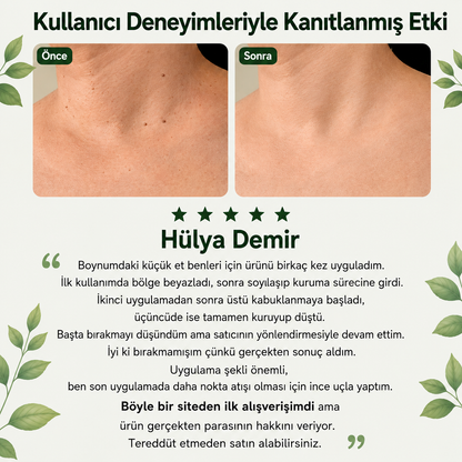 Skinvibe® | Siğil • Nasır • Et Beni Solüsyonu