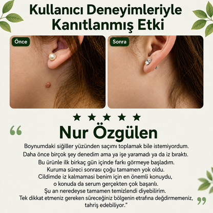 Skinvibe® | Siğil • Nasır • Et Beni Solüsyonu