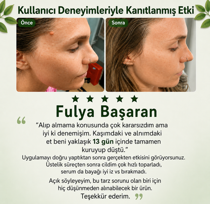 Skinvibe® | Siğil • Nasır • Et Beni Solüsyonu